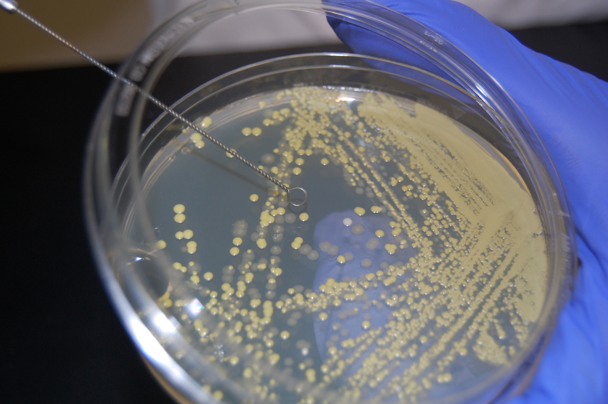 Photograph showing how to pick an isolated colony off a petri plate to obtain a pure culture from a mixture.